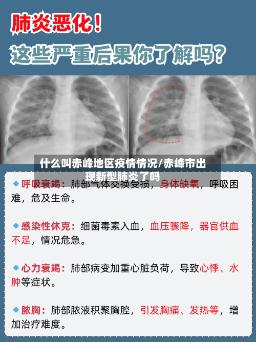 什么叫赤峰地区疫情情况/赤峰市出现新型肺炎了吗-第2张图片