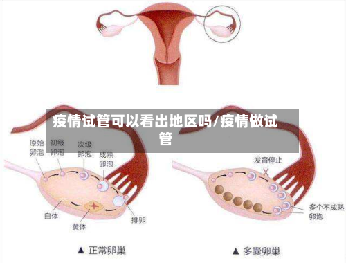疫情试管可以看出地区吗/疫情做试管-第1张图片